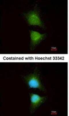 Immunocytochemistry/Immunofluorescence: PI 3-Kinase p110 beta/PIK3CB Antibody [NBP1-33116] -  Analysis of methanol-fixed HeLa, using antibody at 1:200 dilution.