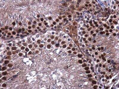 Immunohistochemistry-Paraffin: PI 3-Kinase p110 beta/PIK3CB Antibody [NBP1-33116] - Paraffin-embedded rat testis. PI3K p110 beta antibody [N3C2], Internal diluted at 1:400.