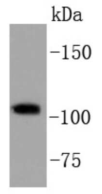 Western Blot: PI 3-Kinase p110 beta/PIK3CB Antibody (SC0580) [NBP2-67579] - Analysis of PI3-kinase p110 subunit beta on Hela cell lysates using anti-PI3-kinase p110 subunit beta antibody at 1/1,000 dilution.