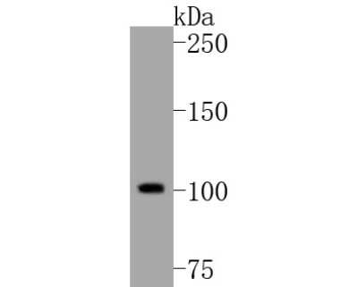 Western Blot: PI 3-Kinase p110 beta/PIK3CB Antibody (SC0580) [NBP2-67579] - Western blot analysis of PI 3-Kinase p110 beta/PIK3CB on Hela cell lysates. Proteins were transferred to a PVDF membrane and blocked with 5% BSA in PBS for 1 hour at room temperature. The primary antibody (1/500) was used in 5% BSA at room temperature for