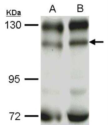 Western Blot: PI 3-Kinase p110 beta/PIK3CB Antibody [NBP1-33116] - Sample (50 ug of whole cell lysate) A: C2C12 B: C2C12+AEA10mM antibody diluted at 1:1000.