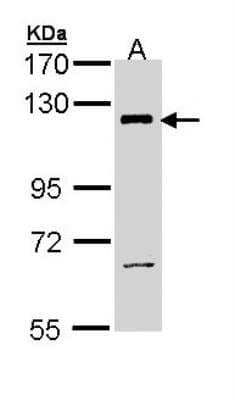 Western Blot: PI 3-Kinase p110 beta/PIK3CB Antibody [NBP1-33116] - Sample (30 ug of whole cell lysate) A: H1299 7.5% SDS PAGE; antibody diluted at 1:1000.