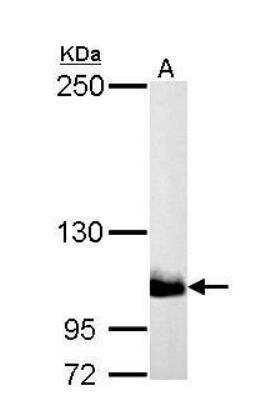 Western Blot: PI 3-Kinase p110 beta/PIK3CB Antibody [NBP1-33116] - A. 30 ug PC-12 whole cell lysate/extract 5 % SDS-PAGE PI3K p110 beta antibody [N3C2], Internal dilution: 1:1000