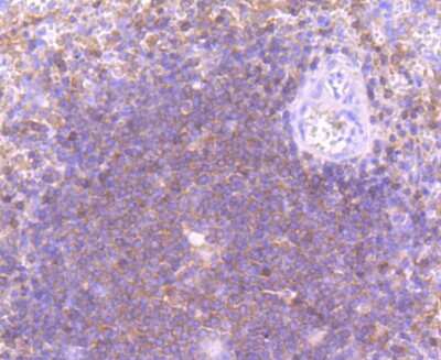 Immunohistochemistry-Paraffin: PI 3-Kinase p110 delta Antibody (JM83-24) [NBP2-67055] - Analysis of paraffin-embedded human spleen tissue using anti-PI 3 Kinase p110 delta antibody. Counter stained with hematoxylin.