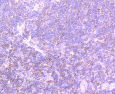 Immunohistochemistry-Paraffin: PI 3-Kinase p110 delta Antibody (JM83-24) [NBP2-67055] - Analysis of paraffin-embedded human tonsil tissue using anti-PI 3 Kinase p110 delta antibody. Counter stained with hematoxylin.