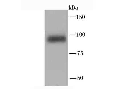Western Blot: PI 3-Kinase p110 delta Antibody (JM83-24) [NBP2-67055] - Analysis of PI 3 Kinase p110 delta on mouse spleen tissue lysate using anti-PI 3 Kinase p110 delta antibody at 1/1,000 dilution.