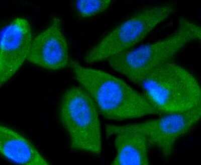 Immunocytochemistry/Immunofluorescence: PI 3-Kinase p55 gamma Antibody (SR44-06) [NBP2-67329] - Staining PI 3 Kinase p55 ? in PC-3M cells (green). The nuclear counter stain is DAPI (blue). Cells were fixed in paraformaldehyde, permeabilised with 0.25% Triton X100/PBS.