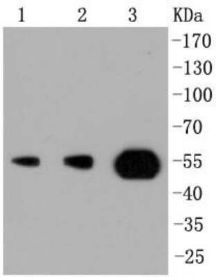 Western Blot: PI 3-Kinase p55 gamma Antibody (SR44-06) [NBP2-67329] - Analysis of PI 3 Kinase p55 on different lysates using anti-PI 3 Kinase p55 antibody at 1/1,000 dilution. Positive control: Lane 1: MCF-7 Lane 2: Jurkat Lane 3: Mouse testis