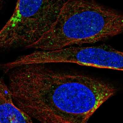 Immunocytochemistry/Immunofluorescence: PI 3-Kinase p85 beta Antibody [NBP2-56360] - Staining of human cell line U-2 OS shows localization to the Golgi apparatus. Antibody staining is shown in green.