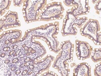 Immunohistochemistry: PI 3-Kinase p85 beta Antibody [NBP2-99487] - Immunochemical staining of human PI 3-Kinase p85 in human duodenum with rabbit polyclonal antibody at 1:1000 dilution, formalin-fixed paraffin embedded sections.