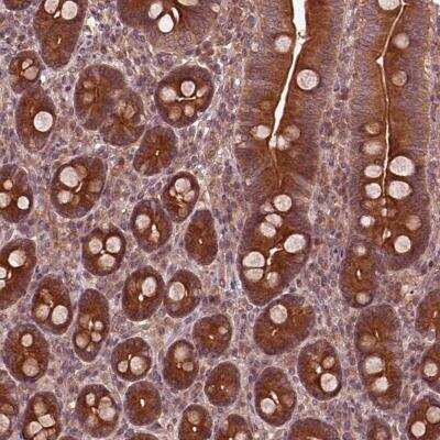 Immunohistochemistry-Paraffin: PI 3-Kinase p85 beta Antibody [NBP2-56360] - Immunohistochemical staining of human duodenum shows strong cytoplasmic positivity in glandular cells.