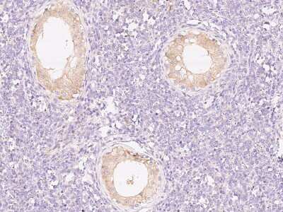 Immunohistochemistry-Paraffin: PI 3-Kinase p85 beta Antibody [NBP2-99487] - Immunochemical staining of human PI 3-Kinase in human testis with rabbit polyclonal antibody at 1:1000 dilution, formalin-fixed paraffin embedded sections.