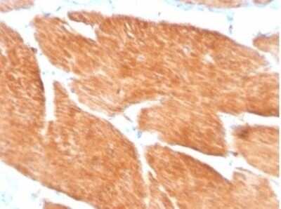 Immunohistochemistry-Paraffin: PI 3-Kinase p85 beta Antibody (PIK3R2/1293) [NBP3-13736] - Formalin-fixed, paraffin-embedded human spleen stained with PI 3-Kinase p85 beta antibody (PIK3R2/1293). HIER: Tris/EDTA, pH9.0, 45min. HRP-polymer, 30min. DAB, 5min.