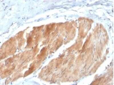 Immunohistochemistry-Paraffin: PI 3-Kinase p85 beta Antibody (PIK3R2/1293) [NBP3-13736] - Formalin-fixed, paraffin-embedded human bladder stained with PI 3-Kinase p85 beta antibody (PIK3R2/1293). HIER: Tris/EDTA, pH9.0, 45min. HRP-polymer, 30min. DAB, 5min.