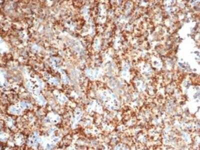 Immunohistochemistry-Paraffin: PI 3-Kinase p85 beta Antibody (PIK3R2/292) [NBP3-13735] - Formalin-fixed, paraffin-embedded human spleen stained with PI 3-Kinase p85 beta antibody (PIK3R2/292). HIER: Tris/EDTA, pH9.0, 45min. HRP-polymer, 30min. DAB, 5min.