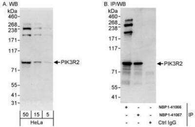 Western Blot: PI 3-Kinase p85 beta Antibody [NBP1-41066] - Whole cell lysate (5, 15 and 50 mcg for WB; 1 mg for IP, 20% of IP loaded) from HeLa cells.   Affinity purified rabbit anti-PIK3R2 antibody used for WB at 0.04 mcg/ml (A) and 1 mcg/ml (B) and used for IP at 10 mcg/mg lysate.  PIK3R2 was also immunoprecipitated by rabbit anti-PIK3R2 antibody NBP1-41067, which recognizes a downstream epitope.