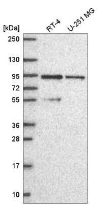 Western Blot PI 3-Kinase p85 beta Antibody - BSA Free