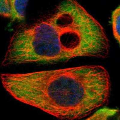 Immunocytochemistry/Immunofluorescence: PI 4 Kinase type 2 beta Antibody [NBP1-87908] - Immunofluorescent staining of human cell line A-431 shows localization to cytosol.