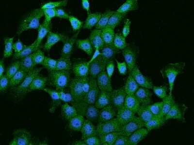 Immunocytochemistry/Immunofluorescence: PI 4 Kinase type 2 beta Antibody [NBP2-97902] - Immunofluorescence staining of PI 4 Kinase type 2 beta in A431 cells. Cells were fixed with 4% PFA, permeabilzed with 0.1% Triton X-100 in PBS, blocked with 10% serum, and incubated with rabbit anti-Human PI 4 Kinase type 2 beta polyclonal antibody (dilution ratio 1:200) at 4C overnight. Then cells were stained with the Alexa Fluor(R)488-conjugated Goat Anti-rabbit IgG secondary antibody (green) and counterstained with DAPI (blue).Positive staining was localized to Cytoplasm.