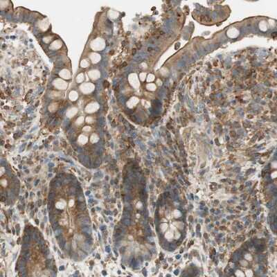Immunohistochemistry-Paraffin: PI 4 Kinase type 2 beta Antibody [NBP1-87908] - Staining of human colon shows moderate cytoplasmic and membranous positivity in glandular cells.