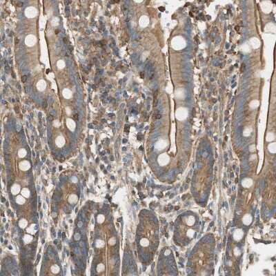 Immunohistochemistry-Paraffin: PI 4 Kinase type 2 beta Antibody [NBP1-87908] - Staining of human duodenum shows moderate to strong membranous positivity in glandular cells.