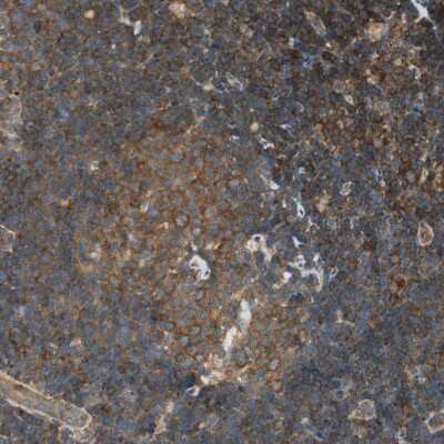 Immunohistochemistry-Paraffin: PI 4 Kinase type 2 beta Antibody [NBP1-87908] - Staining of human lymph node shows moderate to strong membranous positivity in non-germinal and germinal center cells.