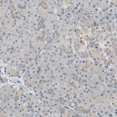 Immunohistochemistry-Paraffin: PI 4 Kinase type 2 beta Antibody [NBP1-87908] - Staining of human pancreas shows very weak positivity in exocrine glandular cells as expected.