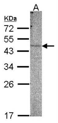 Western Blot: PI 4 Kinase type 2 beta Antibody [NBP1-32263] - Sample(30 ug of whole cell lysate)A:293T7. 5% SDS PAGE, antibody diluted at 1:500.