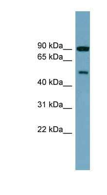 Western Blot: PI 4 Kinase type 2 beta Antibody [NBP1-56547] - 721_B cell lysate, concentration 0.2-1 ug/ml.