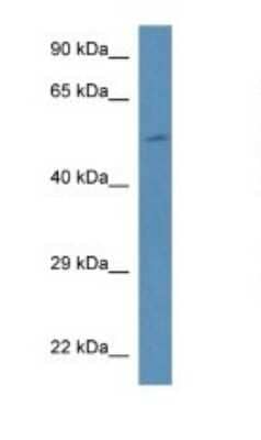 Western Blot: PI 4 Kinase type 2 beta Antibody [NBP1-74233] - Titration: 1.0 ug/ml Positive Control: Mouse Liver.