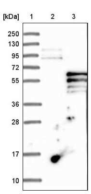 Western Blot: PI 4 Kinase type 2 beta Antibody [NBP1-87908] - Lane 1: Marker [kDa] 250, 130, 95, 72, 55, 36, 28, 17, 10. Lane 2: Negative control (vector only transfected HEK293T lysate). Lane 3: Over-expression lysate (Co-expressed with a C-terminal myc-DDK tag (3.1 kDa) in mammalian HEK293T cells).