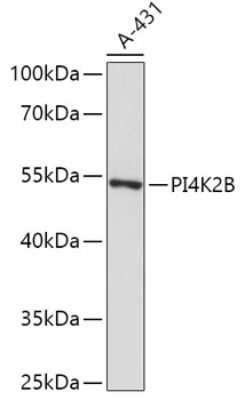 Western Blot: PI 4 Kinase type 2 beta Antibody [NBP2-94379] - Analysis of extracts of A-431 cells, using PI 4 Kinase type 2 beta at 1:1000 dilution.Secondary antibody: HRP Goat Anti-Rabbit IgG (H+L) at 1:10000 dilution.Lysates/proteins: 25ug per lane.Blocking buffer: 3% nonfat dry milk in TBST.Detection: ECL Basic K