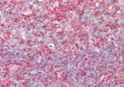 Immunohistochemistry-Paraffin: PIP5K1 alpha Antibody [NBP2-44148] - Staining of human Tonsil Tissue.