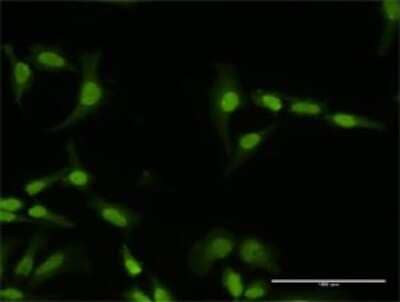 Immunocytochemistry/ Immunofluorescence PI4K2A Antibody - Azide and BSA Free