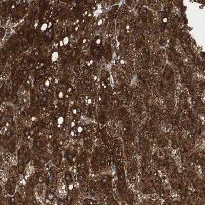 Immunohistochemistry-Paraffin PI4KB/PI4KIII beta Antibody - BSA Free
