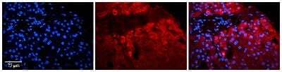 Immunohistochemistry-Paraffin: PI4KB/PI4KIII beta Antibody [NBP3-09346] - Immunohistochemical analysis of formalin-fixed paraffin-embedded human liver tissue.