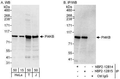 Immunoprecipitation: PI4KB/PI4KIII beta Antibody [NBP2-12814] - Samples:  Whole cell lysate from HeLa (15 and 50 ug for WB; 1 mg for IP, 20% of IP loaded), 293T (T; 50 ug) and Jurkat (J; 50 ug) cells. Antibodies: Affinity purified rabbit anti-PI4KB antibody NBP2-12814 used for WB at 0.1 ug/ml (A) and 1 ug/ml (B) and used for IP at 6 ug/mg lysate.  PI4KB was also immunoprecipitated by rabbit anti-PI4KB antibody NBP2-12815, which recognizes a downstream epitope. Detection: Chemiluminescence with exposure times of 10 seconds (A) and 3 seconds (B).