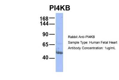 Western Blot: PI4KB/PI4KIII beta Antibody [NBP1-56440] - Human Fetal Heart, Antibody Dilution: 1.0 ug/ml.