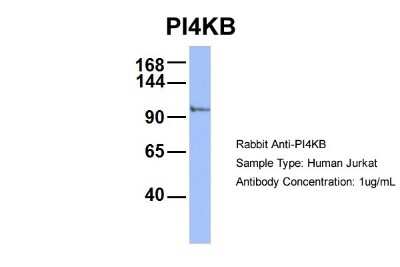 Western Blot: PI4KB/PI4KIII beta Antibody [NBP1-56440] - Sample Type: Jurkat Antibody Dilution: 1.0 ug/ml There is BioGPS gene expression data showing that PI4KB is expressed in Jurkat