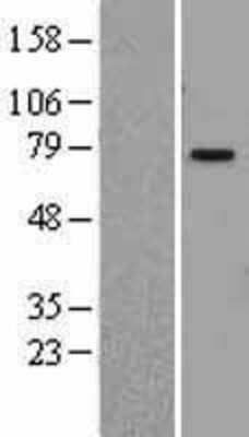 Western Blot PIAS1 Overexpression Lysate