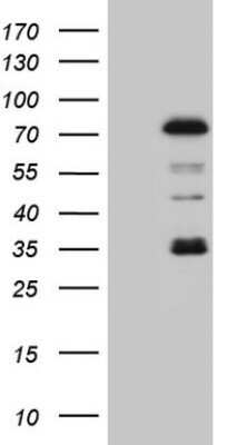 Western Blot: PIAS2 Antibody (OTI2B5) - Azide and BSA Free [NBP2-73398] - Analysis of HEK293T cells were transfected with the pCMV6-ENTRY control (Left lane) or pCMV6-ENTRY PIAS2.