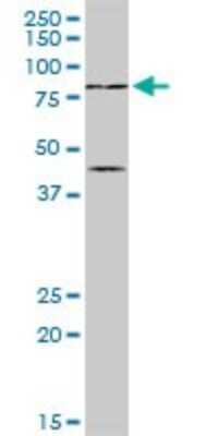 Western Blot: PIAS2 Antibody [H00009063-D01P] - Analysis of PIAS2 expression in human pancreas.