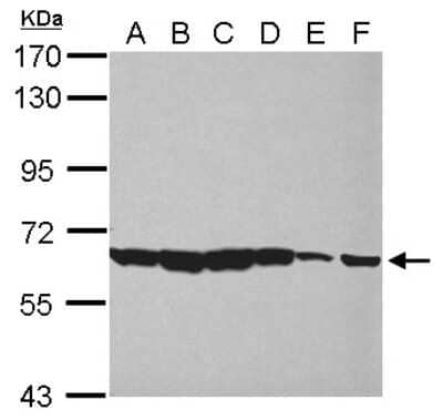 Western Blot: PIAS2 Antibody [NBP2-19819] - Sample (30 ug of whole cell lysate) A: Jurkat B: Raji C: K562 D: THP-1 E: HL-60 F: NCI-H929 7. 5% SDS PAGE gel, diluted at 1:1000.