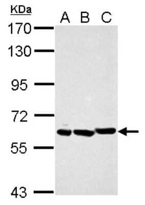 Western Blot: PIAS2 Antibody [NBP2-19819] - Sample (30 ug of whole cell lysate) A: NIH-3T3 B: JC C: BCL-1 7. 5% SDS PAGE gel, diluted at 1:10000.