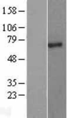 Western Blot: PIAS2 Overexpression Lysate (Adult Normal) [NBL1-14385] Left-Empty vector transfected control cell lysate (HEK293 cell lysate); Right -Over-expression Lysate for PIAS2.