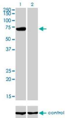 Western Blot: PIAS3 Antibody (4F12) [H00010401-M03] - Western blot analysis of PIAS3 over-expressed 293 cell line, cotransfected with PIAS3 Validated Chimera RNAi or non-transfected control. Blot probed with H00010401-M03. GAPDH (36.1 kDa) used as loading control.