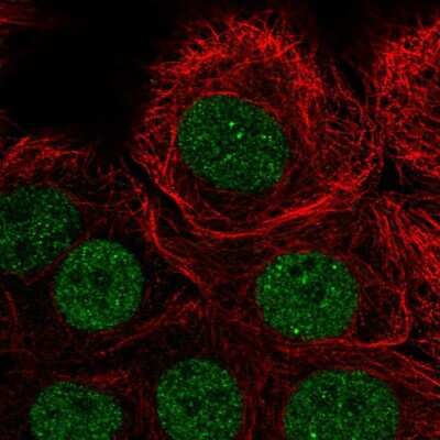 Immunocytochemistry/Immunofluorescence: PIAS3 Antibody [NBP2-57238] - Staining of human cell line MCF7 shows localization to nucleoplasm.