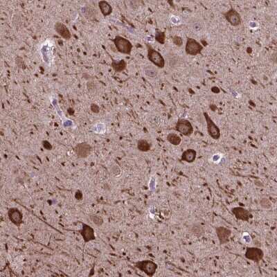 Immunohistochemistry: PIAS3 Antibody [NBP2-48503] - Staining of human hippocampus shows strong cytoplasmic positivity in neuronal cells.