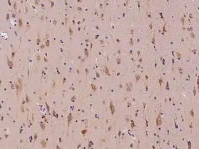 Immunohistochemistry-Paraffin: PIAS3 Antibody [NBP2-98547] - Immunochemical staining of human PIAS3 in human brain with rabbit polyclonal antibody at 1:100 dilution, formalin-fixed paraffin embedded sections.