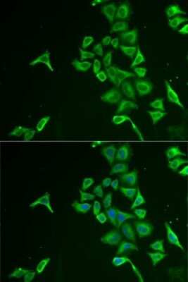 Immunocytochemistry/Immunofluorescence: PIB5PA Antibody [NBP2-94054] - Analysis of U2OS cells using PIB5PA . Blue: DAPI for nuclear staining.